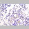Medula osea SF 03.jpg